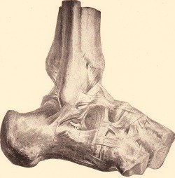Ankle external ligaments, in ankle sprain.